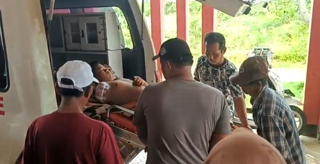 Tangan Kanan Siswa SMP di Seluma Putus, Kecelakaan Kerja di Pabrik Batu Bata