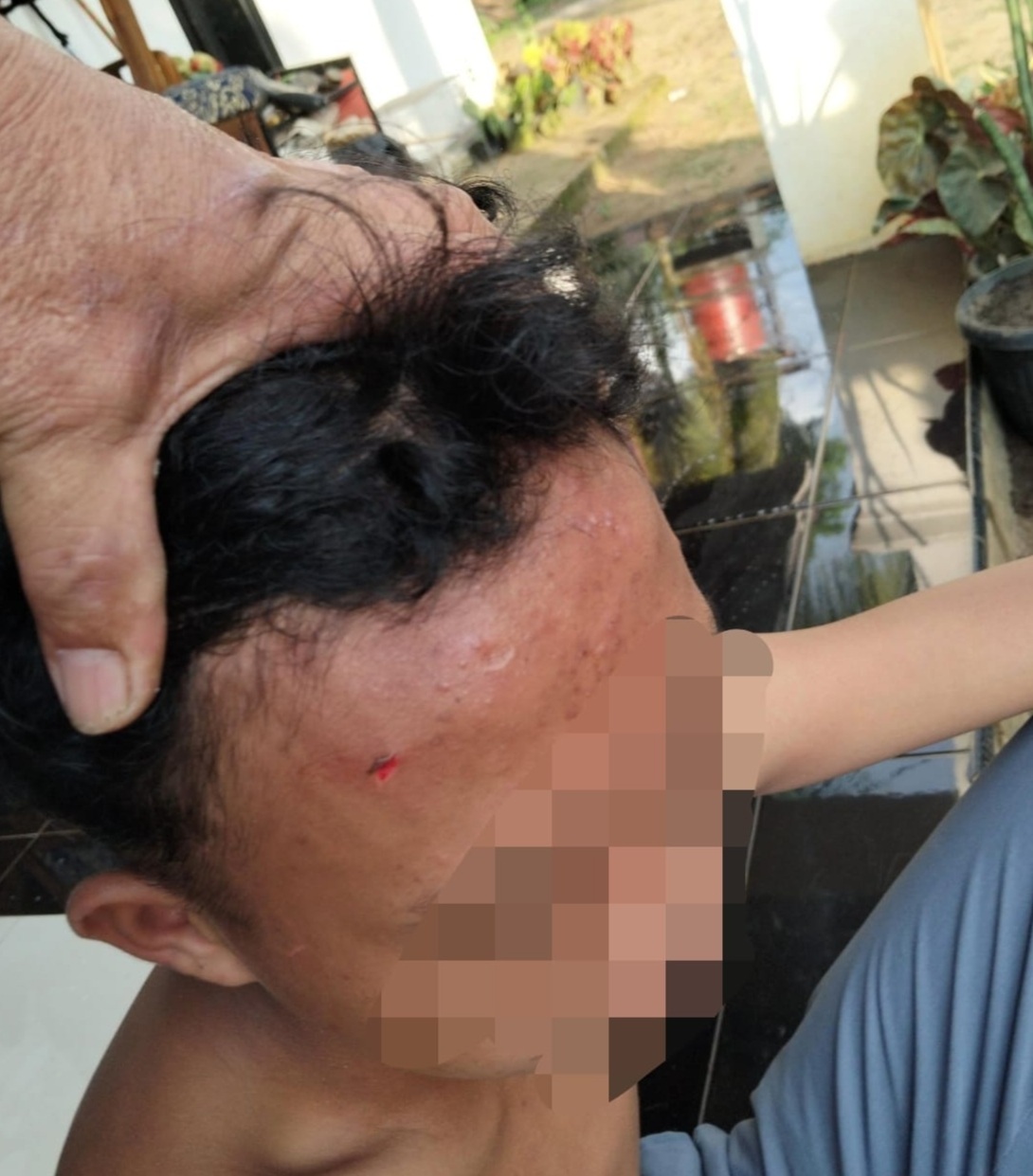   Siswa SMKN 2 Seluma Dikeroyok, Orangtua Korban Lapor Polisi