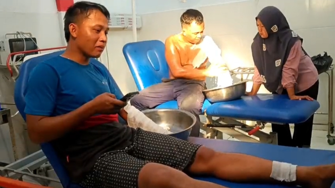 Hari Terakhir Kerja, Rebusan TBS Sawit Meledak Dua Karyawan PT BSL II Seluma Alami Luka Bakar