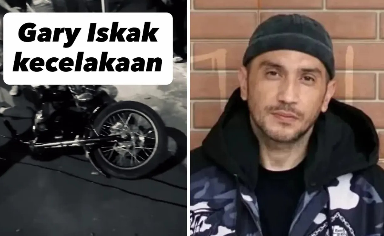 Aktor  Gary Iskak Meninggal Akibat Kecelakaan, Ini Kronologinya