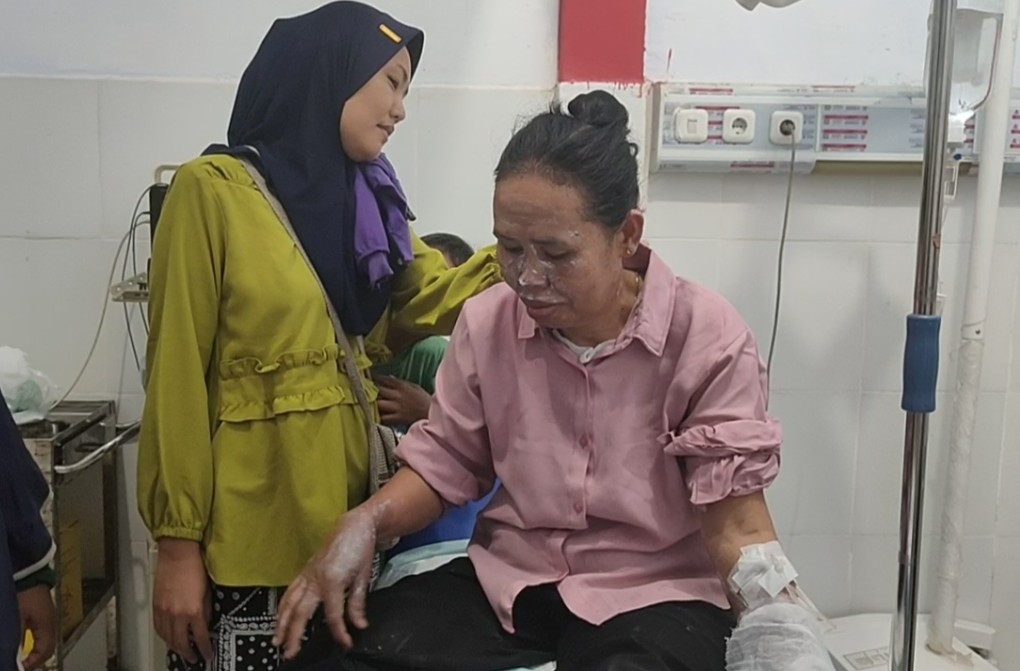 Akibat Tabung Gas Melon Meledak, Karyawan Warung Makan di Seluma Luka Bakar
