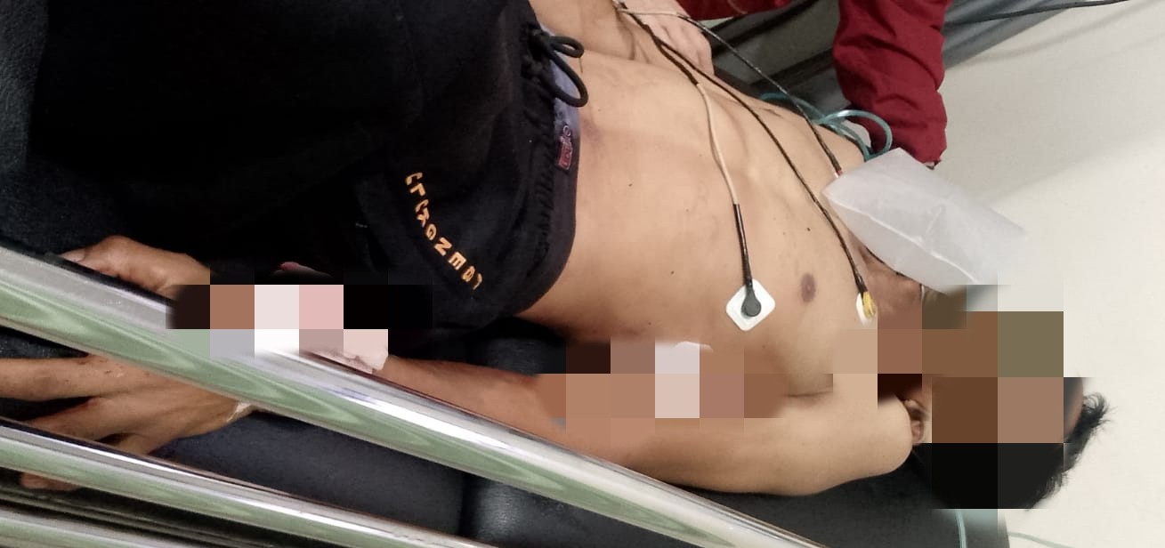 Aksi Begal di Kota Bengkulu,  Satpam DPRD Bengkulu  Dibacok dan Motor Digasak