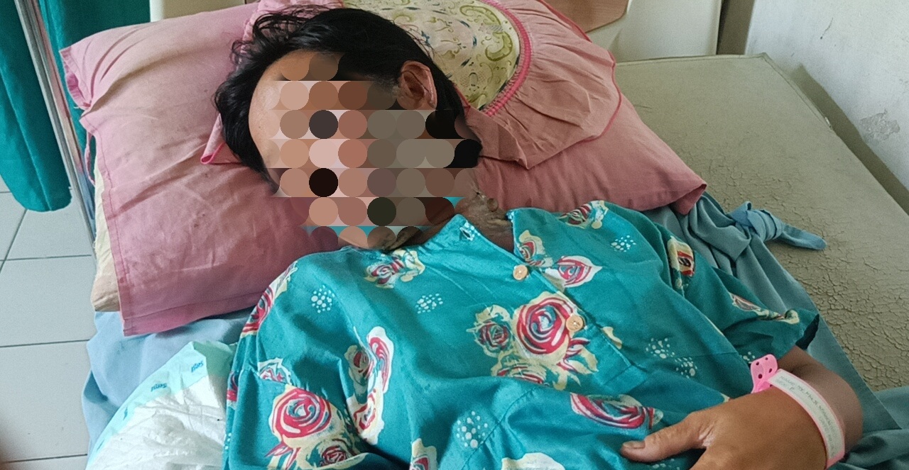  Diduga Dipicu Masalah Ekonomi, IRT di Seluma Disiram Air Panas oleh Suami