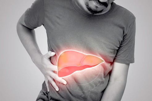 Jangan Tunggu Kuning, Hepatitis Masih Jadi Epidemi Diam di Indonesia     