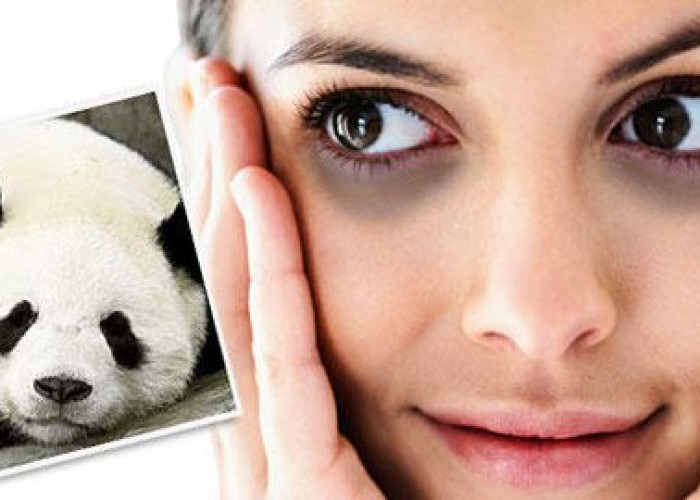 Minyak Zaitun Juga Mempunyai Khasiat Luar Biasa untuk Mengatasi Mata Panda,