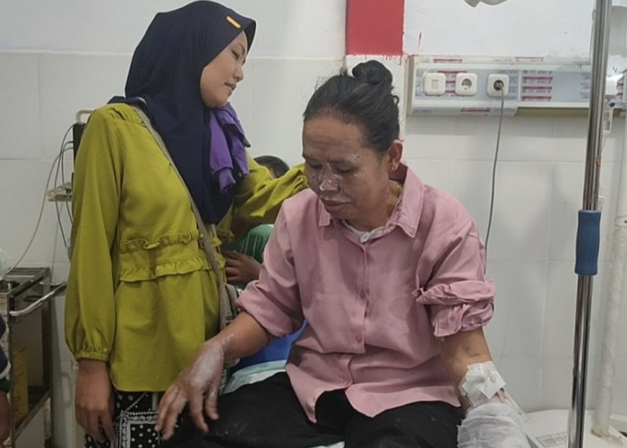 Akibat Tabung Gas Melon Meledak, Karyawan Warung Makan di Seluma Luka Bakar