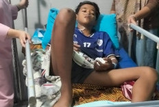  Remaja Ini Naas, Tersengat Listrik Saat Petik Kelapa Muda